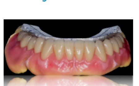 Occlusione e funzione masticatoria: conoscenze imprescindibili per un corretto sviluppo e funzionamento dell’apparato stomatognatico